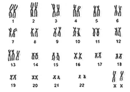 كروموسومات
